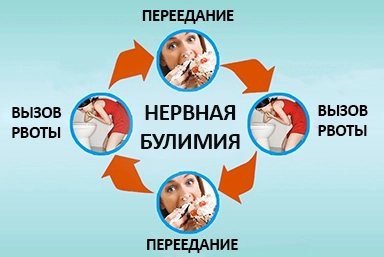 Лечение булимии в Сунтаре